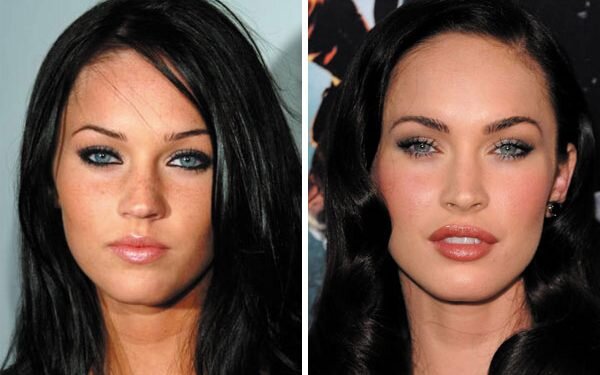 La rinoplastia perfecta estilo Barbie ya no tiene cabida en la era de la positividad corporal