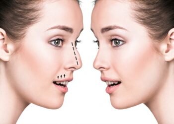 ¿Qué puede hacer una rinoplastia?