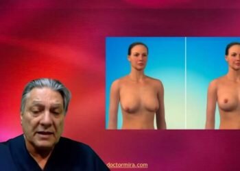 Elevar el pecho: una compleja intervención