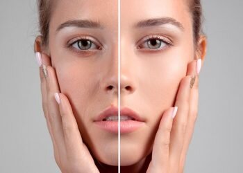 Mesoterapia facial, cuello, escote y manos: