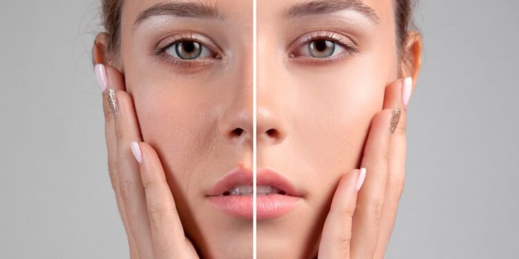 Mesoterapia facial, cuello, escote y manos: