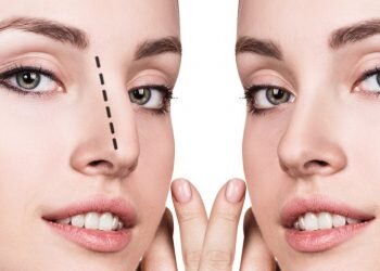 10 hechos fascinantes sobre la rinoplastia que debes saber